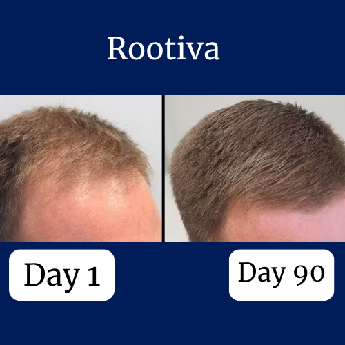 Rootiva Natural Roll On System