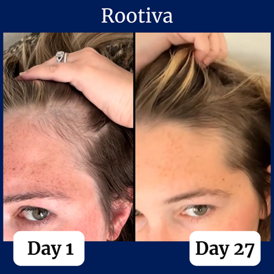 Rootiva Natural Roll On System